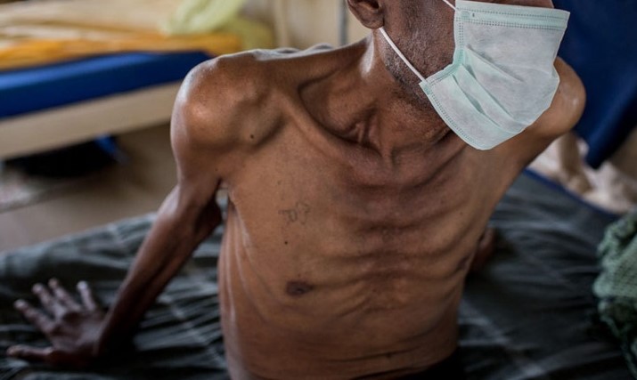 Over 100,000 Unaware Individuals Spreading HIV in Ghana