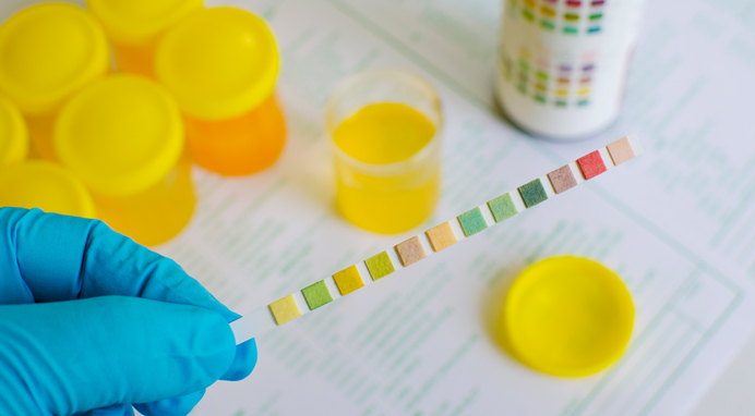 MID-STREAM SPECIMEN OF URINE, NMC Osce Clinical Station